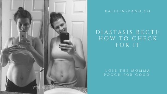 How to Check for Diastasis Recti (and What to Do Next)